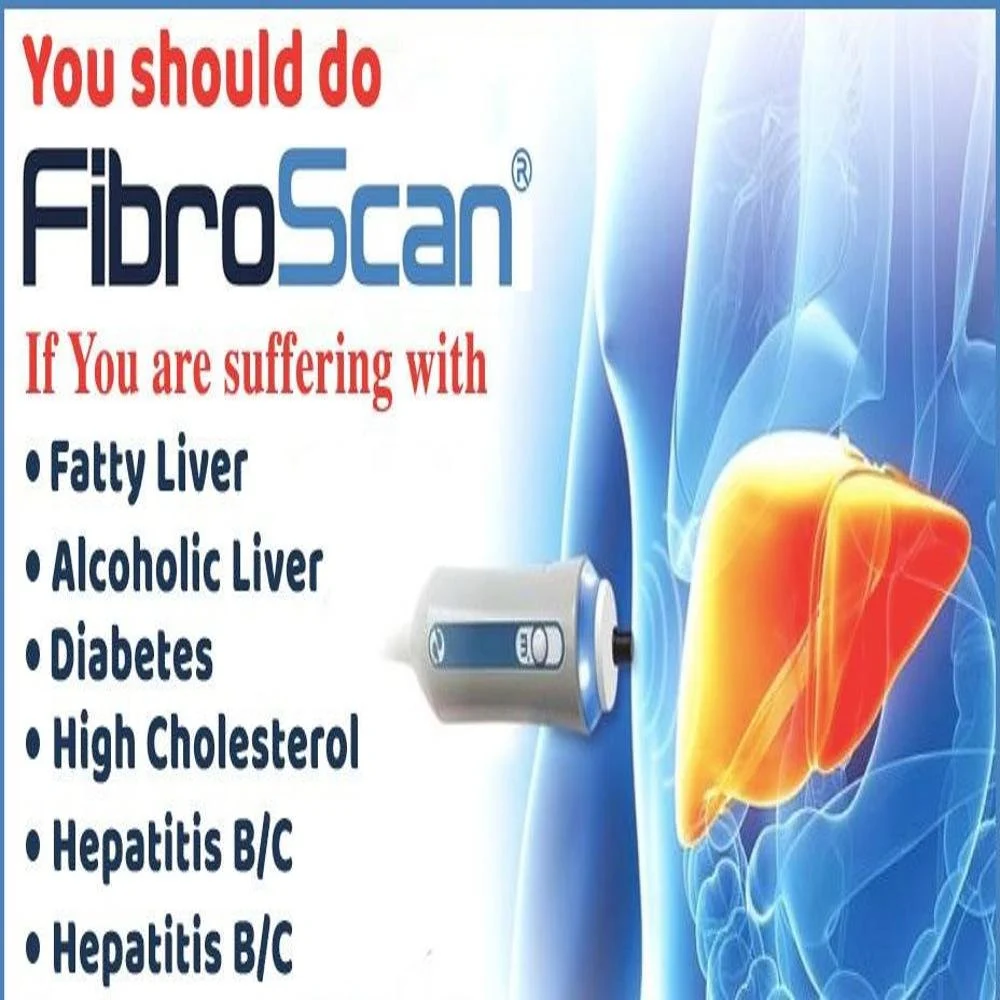 Fibroscan Test