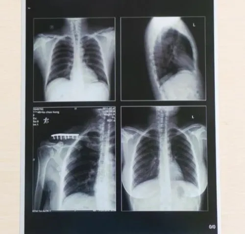 Kalinga Biomedical X Ray Films Fujifilm