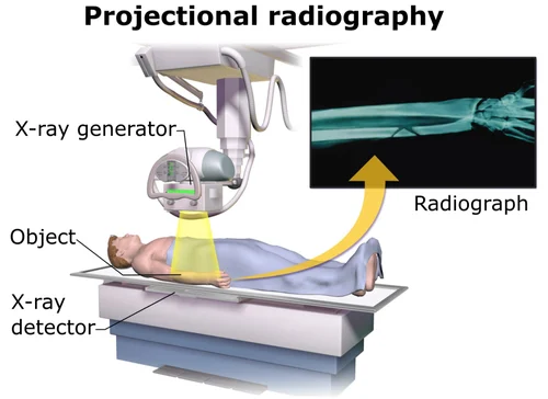 X-Ray Detector Instrument