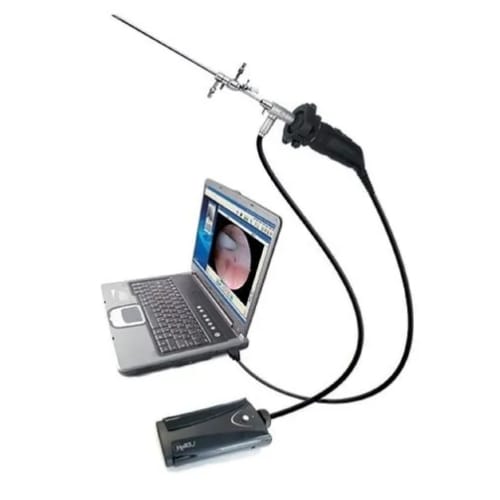 Office Hysteroscopy Diagnostic System