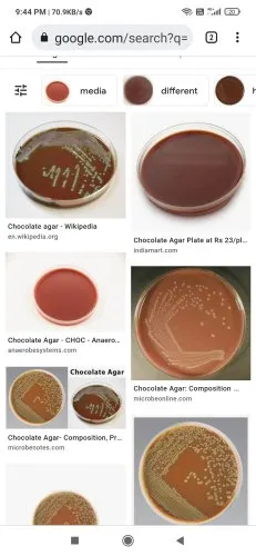 Chocolate agar plate