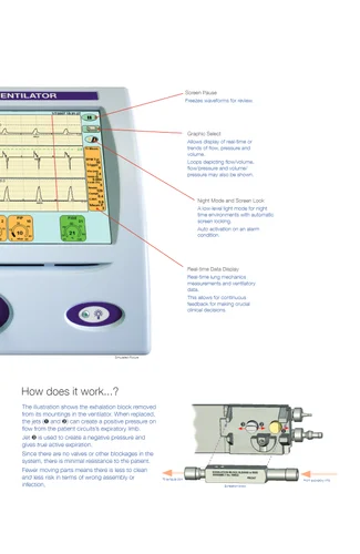 Respiratory Care Equipment-Neonatal Ventilator Machine