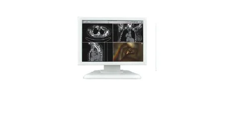 Silver Medical Grade Monitor- 19 inch, 376.32 X 301.056 Mm, GASTROSCOPY