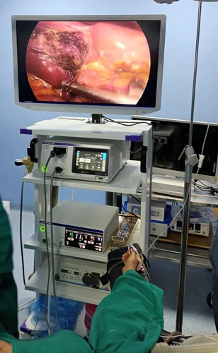 Laparoscopy system