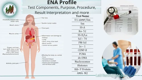 ENA 6 Parameters Profile